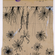 Injured Purkinje neurons of the cerebellum, 1914